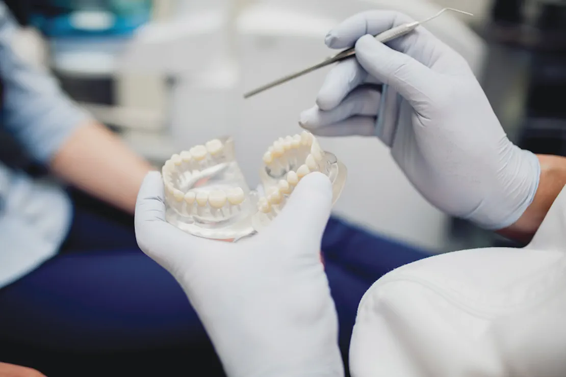 How Long Do Dental Crowns Last? Unveiling the Facts at GDental